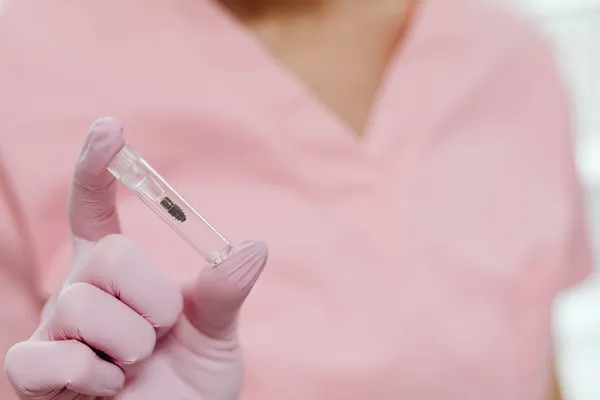 Titanium dental implant post used in All-on-4 full arch implant treatment — the same components available at Turkish clinics