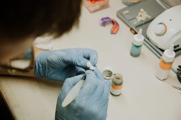 Dental laboratory technician crafting a same-day teeth prosthesis — precision lab work for immediate loading implant restorations