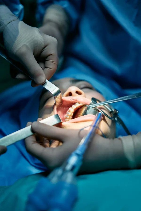 Dental surgery team performing an All-on-6 implant procedure at a specialist clinic — qualified surgeons working to high clinical standards